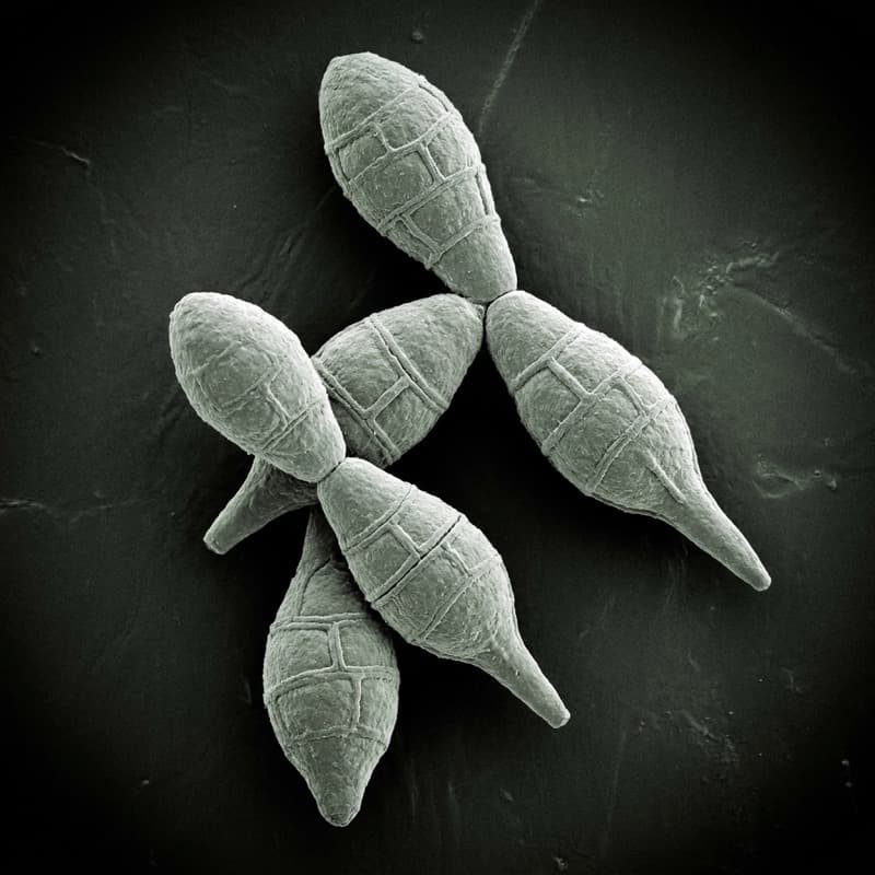 Alternaria при большом увеличении