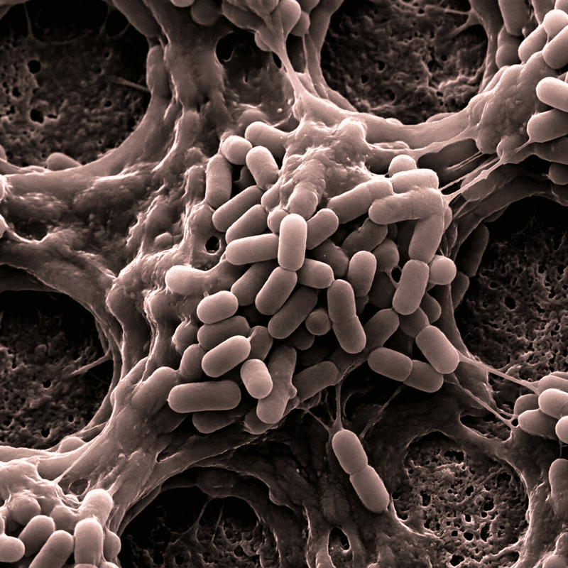 Serratia marcescens при большом увеличении